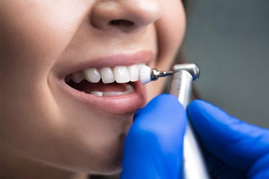 A dental cleaning near River Oaks