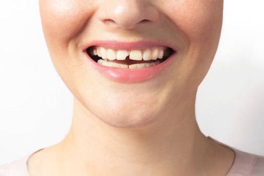 A woman with a broken tooth near River Oaks